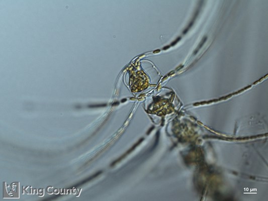Photo of Chaetoceros convolutus